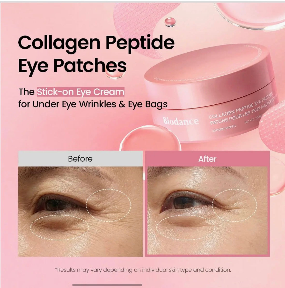 BIODANCE – Patchs Yeux meptides de collagène 60 unités