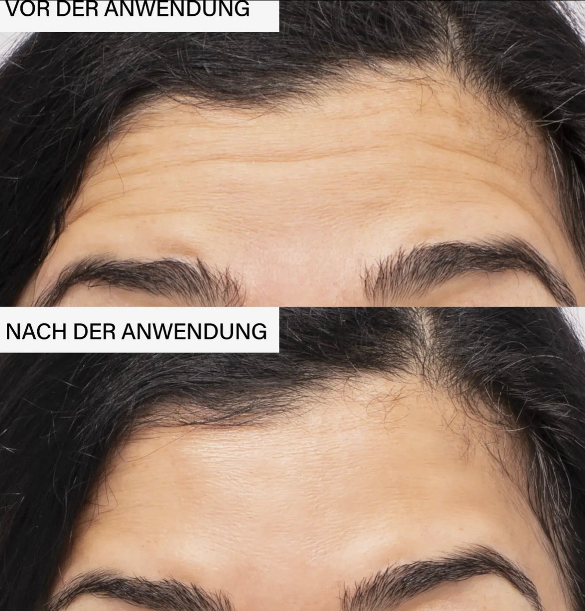 Masque effet lifting botanique |  acide hyarulonique et caféine
