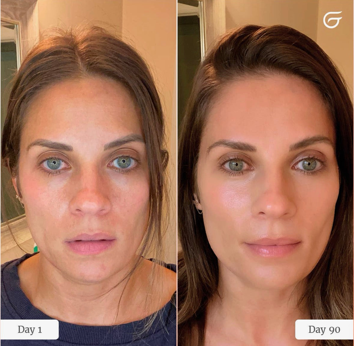 Masque de luminotherapie Glow Up /